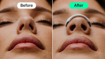 Best Nasal Strips for Deviated Septum: What Helped Me Breathe Better Without Surgery
